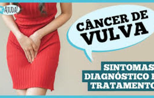 Já ouviu falar de câncer de vulva? Caroço, coceira e feridas podem ser sintomas