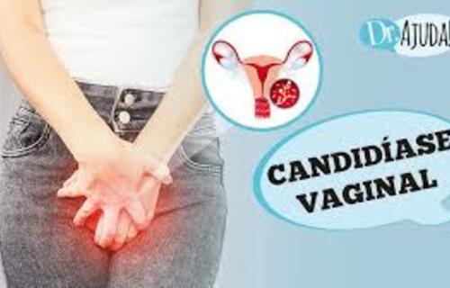 Candidíase Vaginal: o que é, sintomas, diagnóstico, tratamento e prevenção