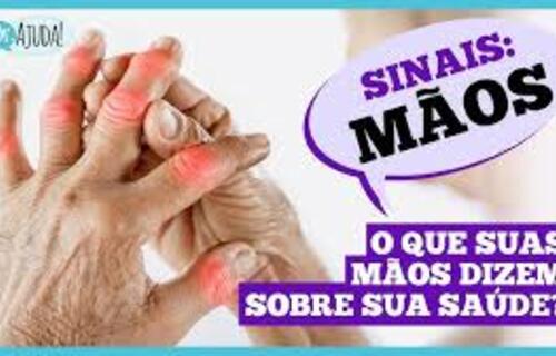 Dr. Ajuda: O que suas mãos podem dizer sobre sua saúde