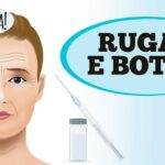 dr.-ajuda:-rugas-e-botox