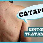 catapora:-sintomas,-complicacoes-e-prevencao