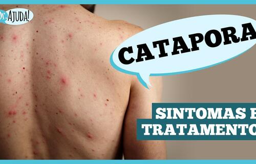 catapora:-sintomas,-complicacoes-e-prevencao