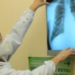 baixo-financiamento-mundial-ameaca-combate-a-tuberculose