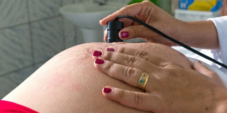 oms:-300-mil-mulheres-morrem-anualmente-em-razao-de-gravidez-ou-parto