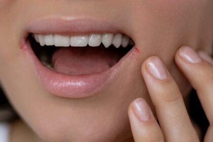 a-misteriosa-ligacao-entre-o-herpes-e-o-mal-de-alzheimer