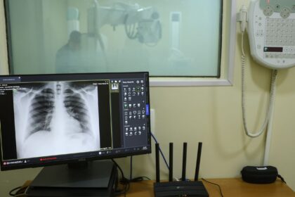brasil-tem-aumento-de-hospitalizacoes-por-influenza-a,-alerta-fiocruz