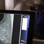 cancer-de-mama:-uma em-cada-tres pacientes tem-menos-de-50-anos