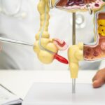 cancer-de-apendice-aumenta-entre-a-geracao-mais-jovem-–-novo-estudo