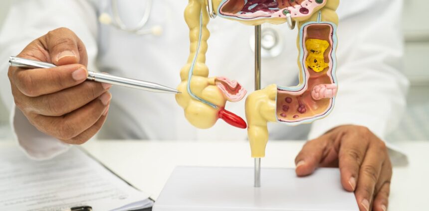 cancer-de-apendice-aumenta-entre-a-geracao-mais-jovem-–-novo-estudo