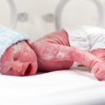 nova-plataforma-reduz-custo-e-facilita-monitoramento-neurologico-de-prematuros