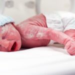 nova-plataforma-reduz-custo-e-facilita-monitoramento-neurologico-de-prematuros