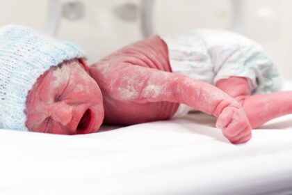 nova-plataforma-reduz-custo-e-facilita-monitoramento-neurologico-de-prematuros