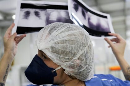 cancer-de-pulmao:-15%-dos-casos-acontecem-em-nao-fumantes