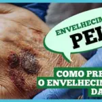 envelhecimento-da-pele:-como-prevenir