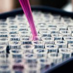 pesquisas-brasileiras-avancam-no-diagnostico-de-alzheimer