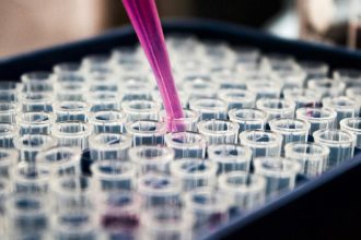 pesquisas-brasileiras-avancam-no-diagnostico-de-alzheimer