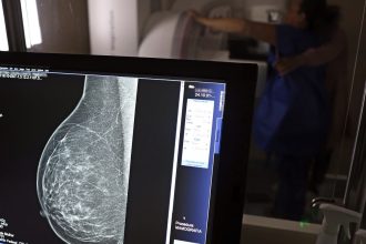 falta-de-acesso-a-mamografos-limita-prevencao-do-cancer-de-mama