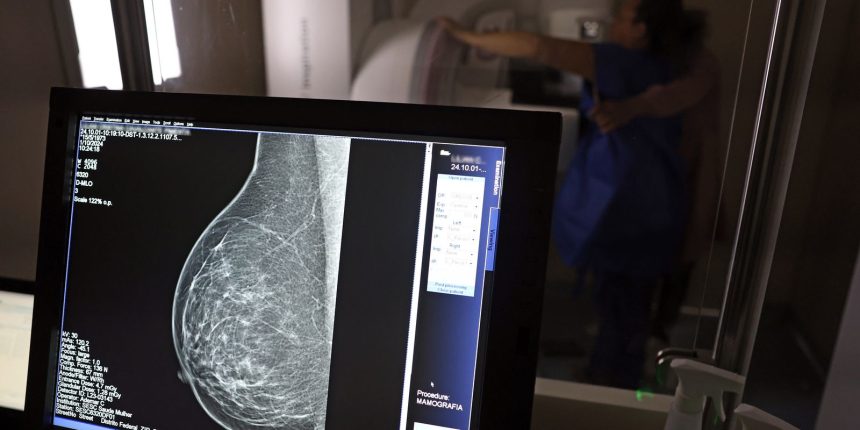 falta-de-acesso-a-mamografos-limita-prevencao-do-cancer-de-mama