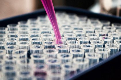 estudo-mostra-que-inflamacao-no-cerebro-pode-ser-chave-do-alzheimer