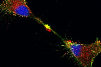 biologia-celular:-a-surpreendente-jornada-da-proteina-prion-no-cerebro