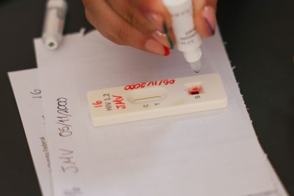 acao-no-df-oferece-testagem-rapida-e-informacao-sobre-hiv/aids