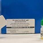 novo-teste-faz-diagnostico-de-hantavirose-em-20-minutos