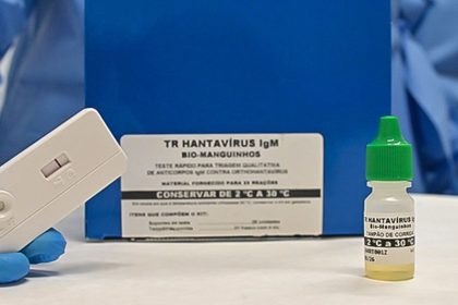 novo-teste-faz-diagnostico-de-hantavirose-em-20-minutos
