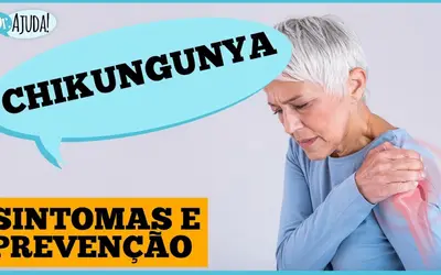 chikungunya:-dor-nas-articulacoes-que-pode-durar-meses